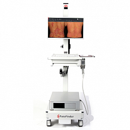Fotofinder